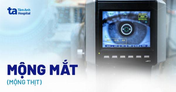 Tránh Sao Chép Ảnh Ref Máy Móc Trong Nhiếp Ảnh
